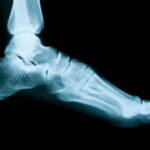 vitamine und knochen